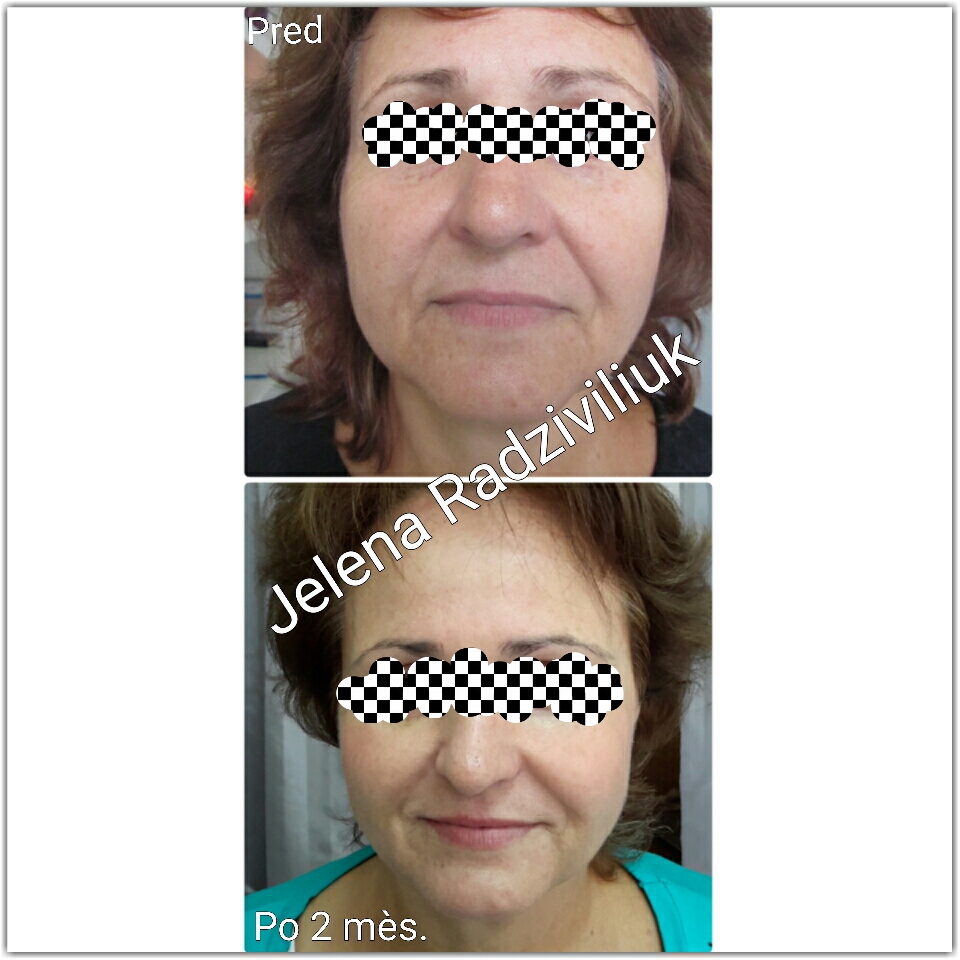 Jelena Radziviliuk foto 4