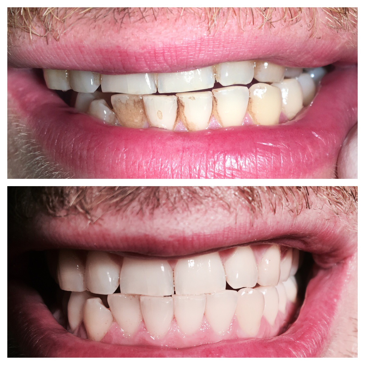 Dentální hygiena - Vojtěch Konschill, DiS. foto 2