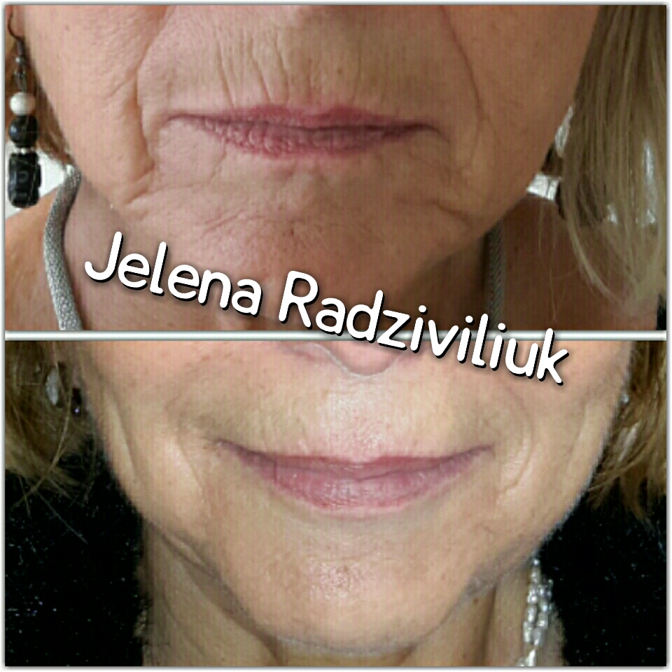 Jelena Radziviliuk foto 3