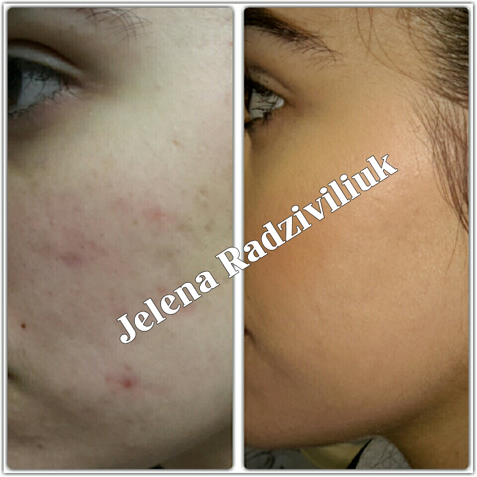 Jelena Radziviliuk foto 2