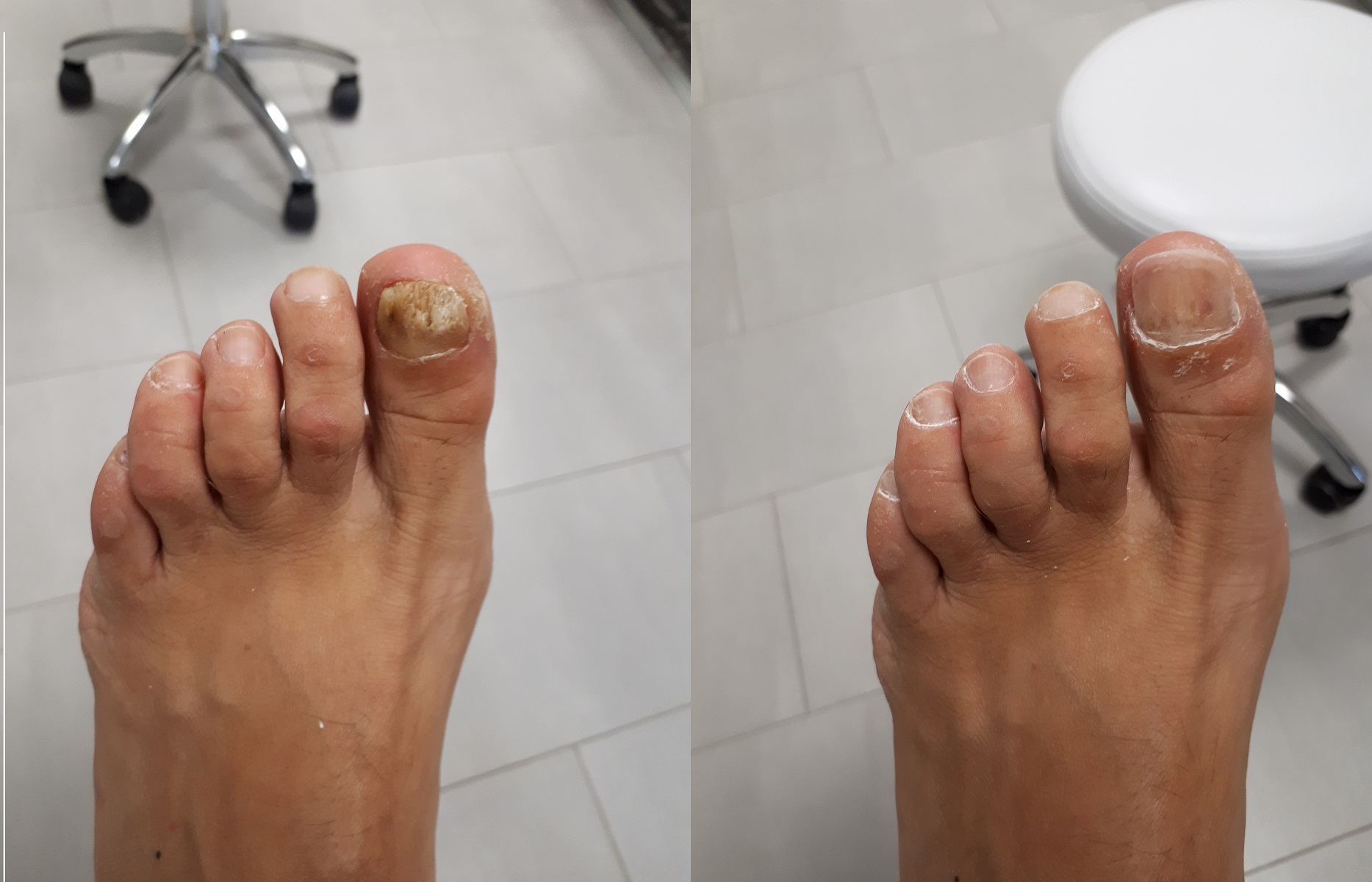 Pedikúra Bc. Zuzana Mynářová foto 3