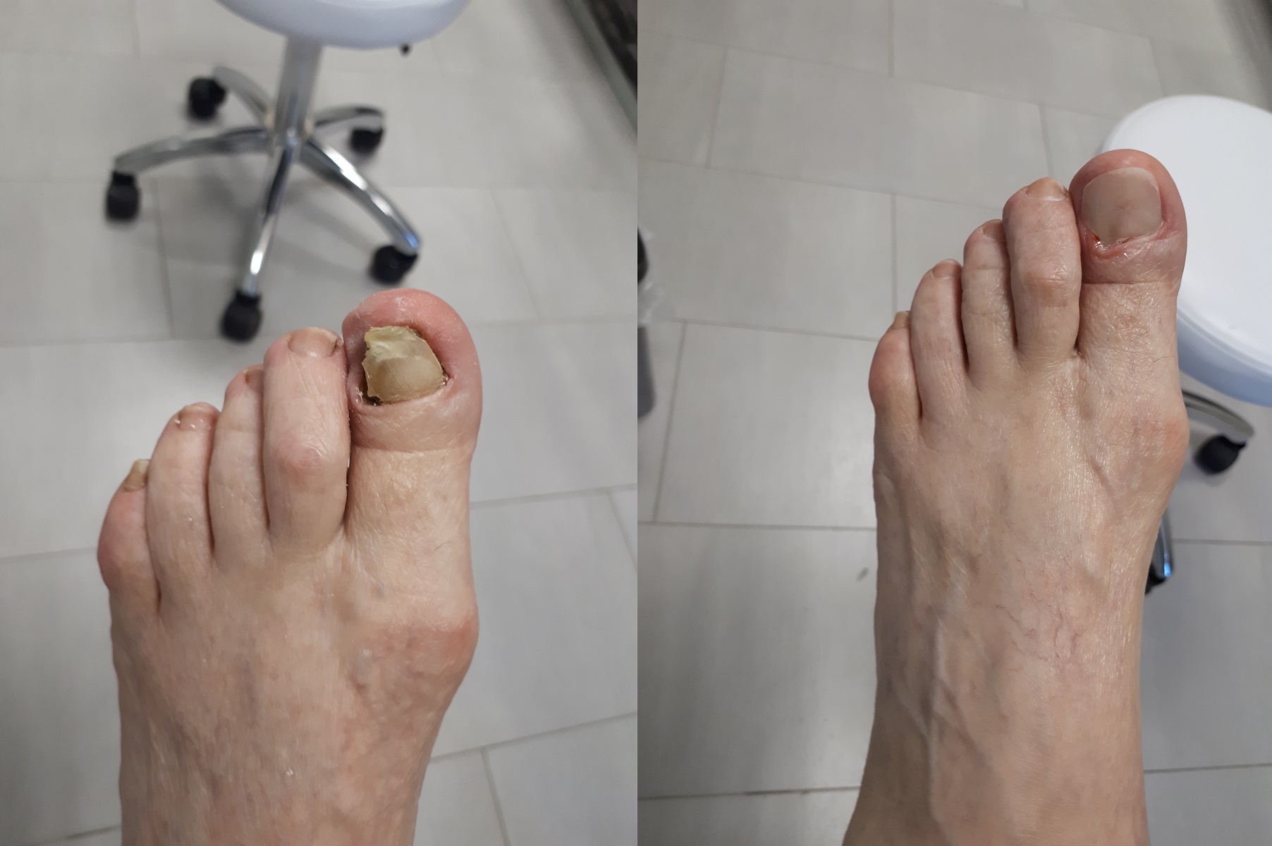 Pedikúra Bc. Zuzana Mynářová foto 2