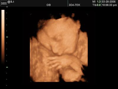 GYNPRENATAL foto 2