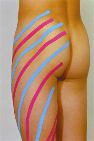 Kinesio-tejping.cz foto 2