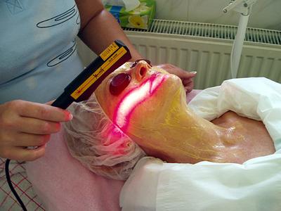 LASER ORIONIS THERAPY foto 2