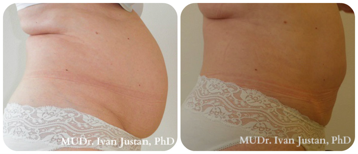 Plastická a estetická chirurgie, MUDr. Ivan Justan foto 4