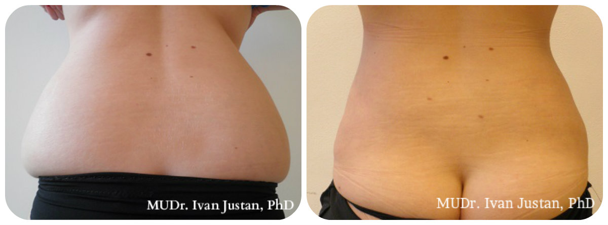 Plastická a estetická chirurgie, MUDr. Ivan Justan foto 3