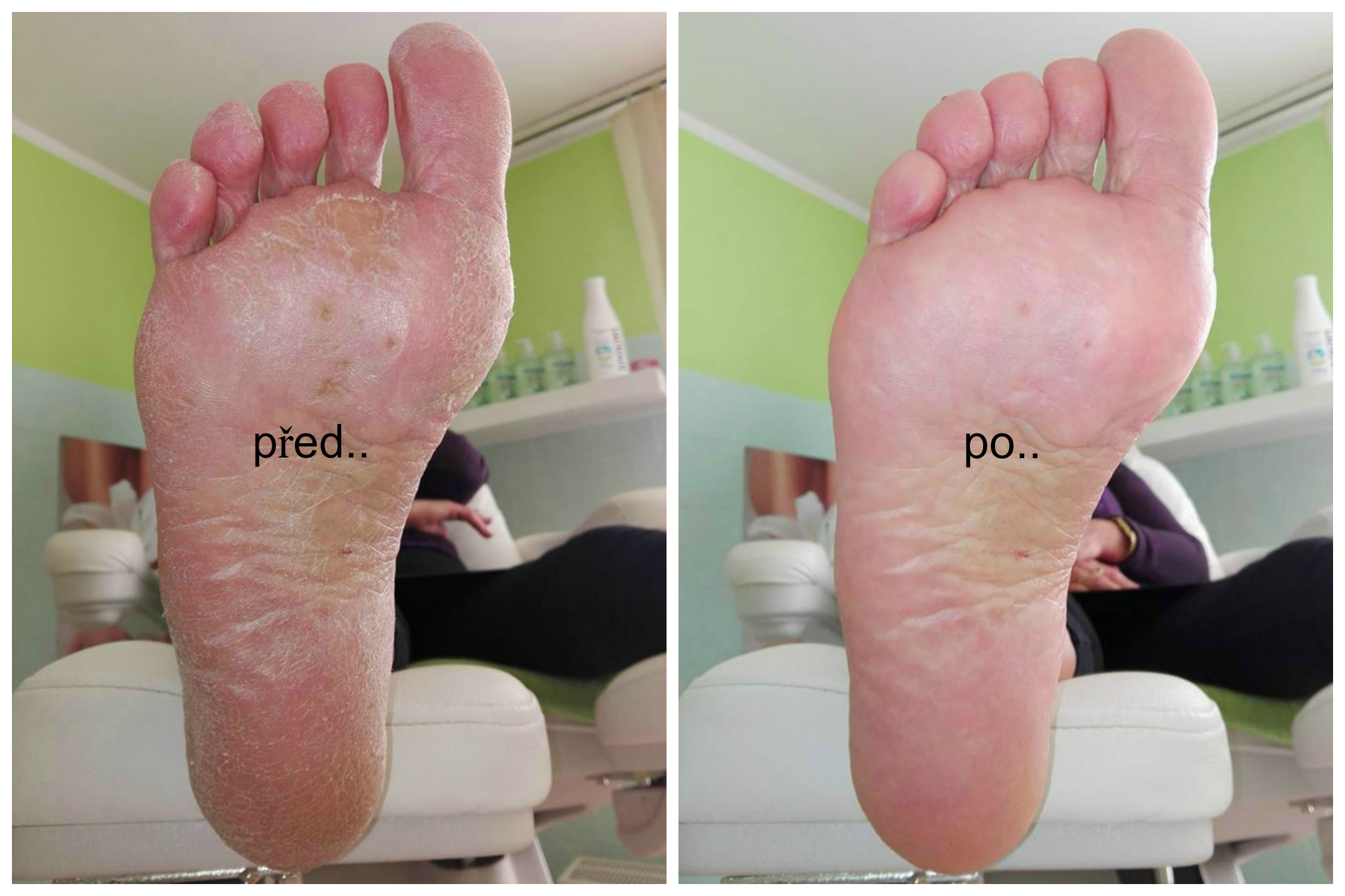 Petra Cermanová - Přístrojová pedikúra Jičín foto 5
