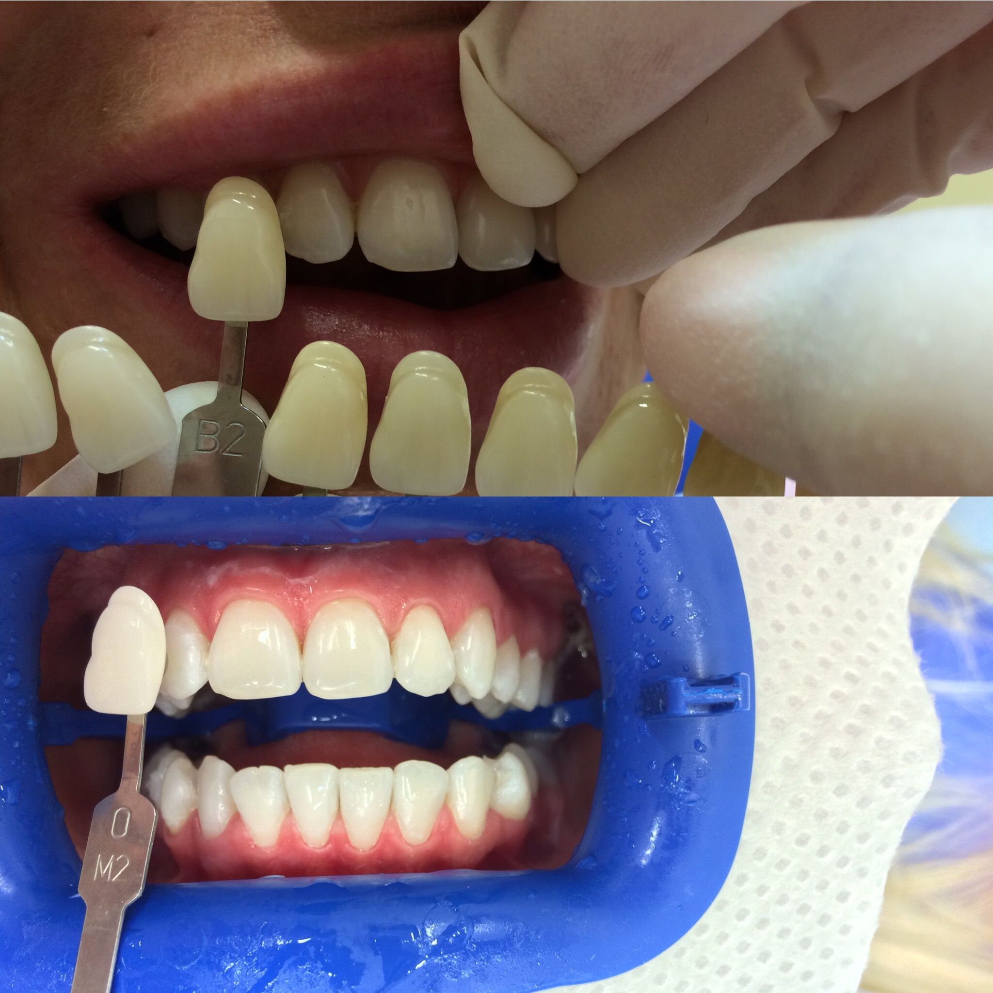 Perfect Smile s.r.o. - MUDr. Jana Fendrychová foto 2