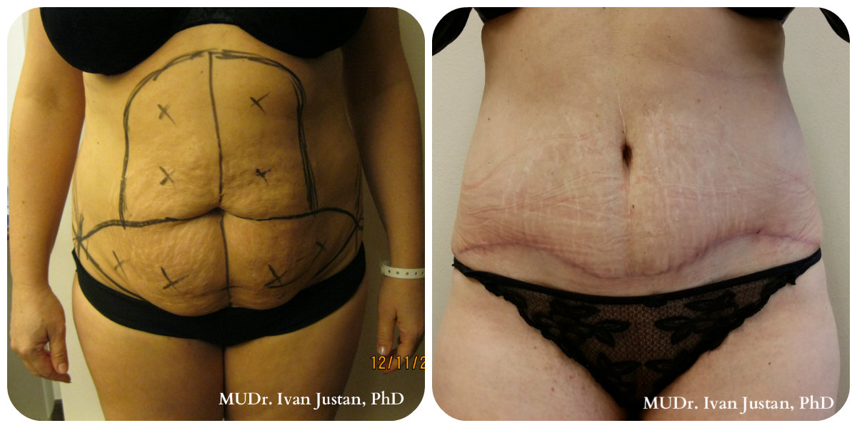 Plastická a estetická chirurgie, MUDr. Ivan Justan foto 3