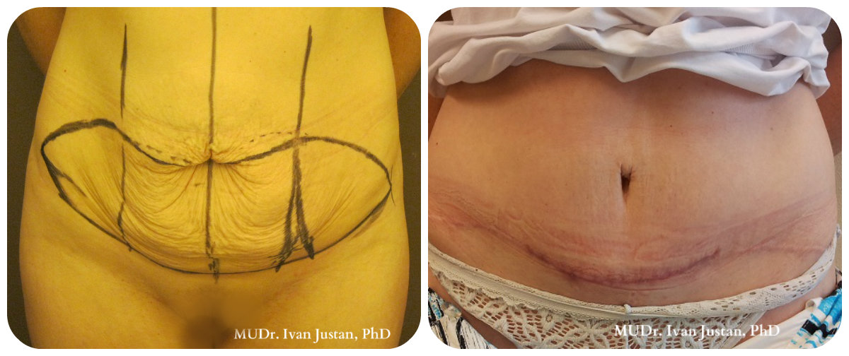 Plastická a estetická chirurgie, MUDr. Ivan Justan foto 2