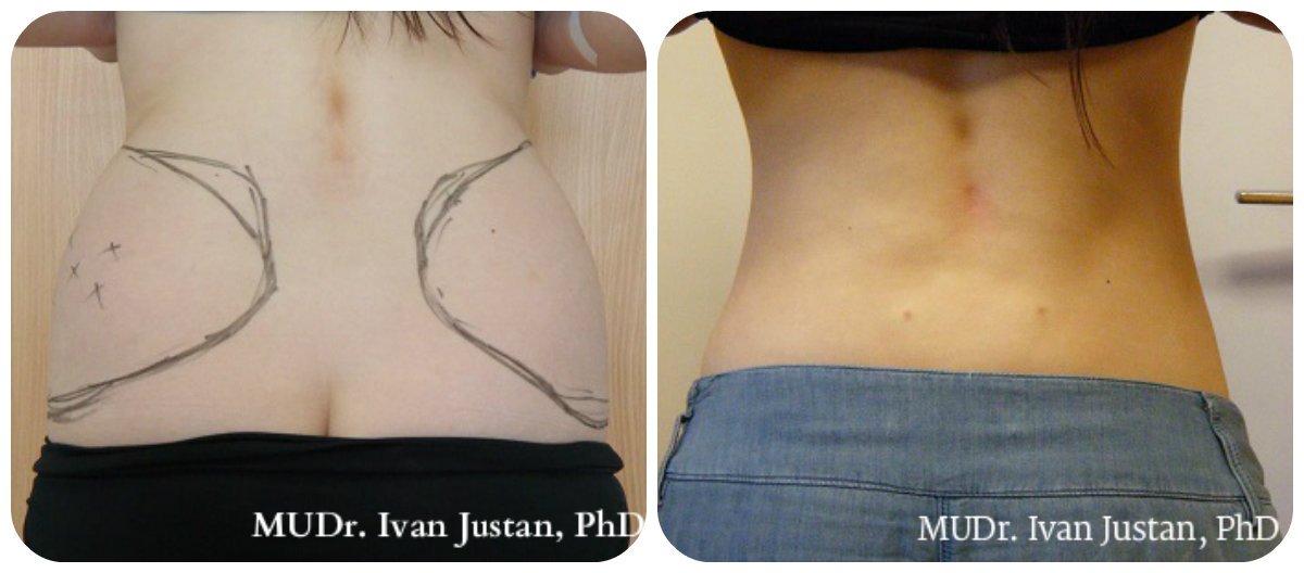 Plastická a estetická chirurgie, MUDr. Ivan Justan foto 2