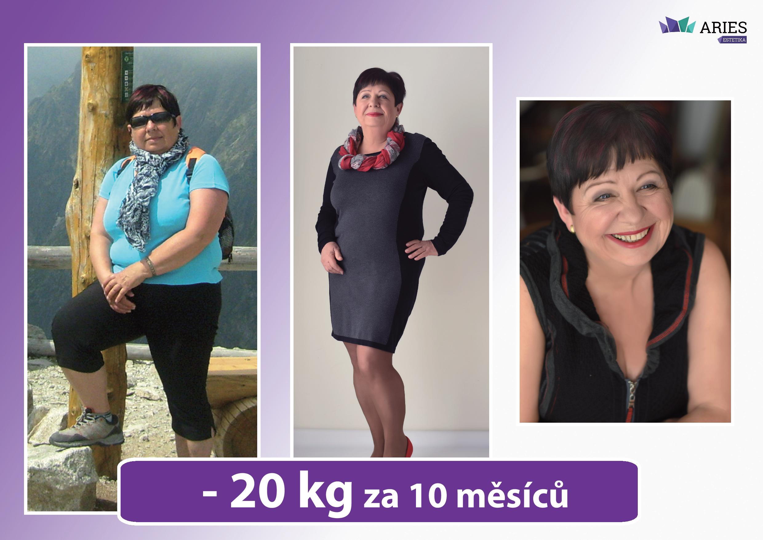 ARIES, klinika komplexní estetiky, s.r.o. foto 2