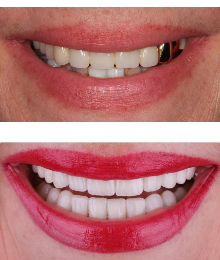 Smile Centrum Lab foto 4