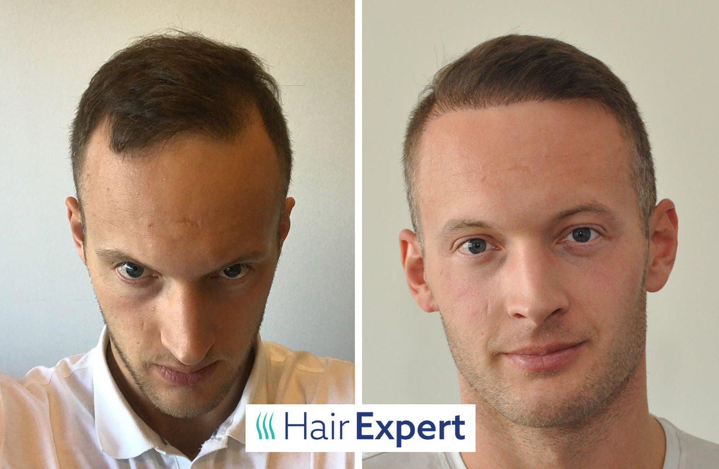HairExpert foto 2