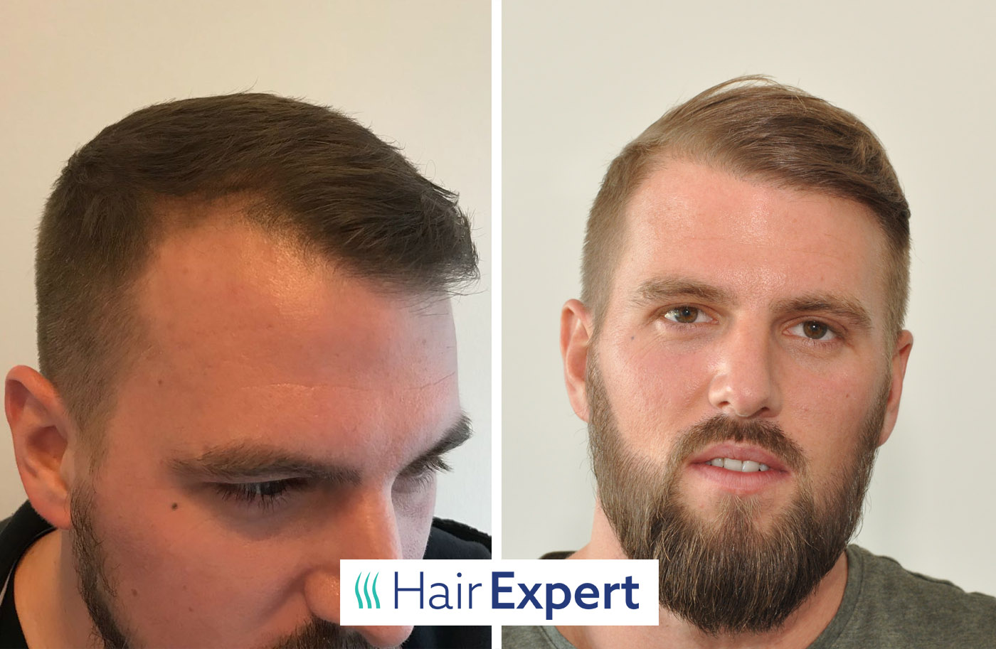 HairExpert foto 5