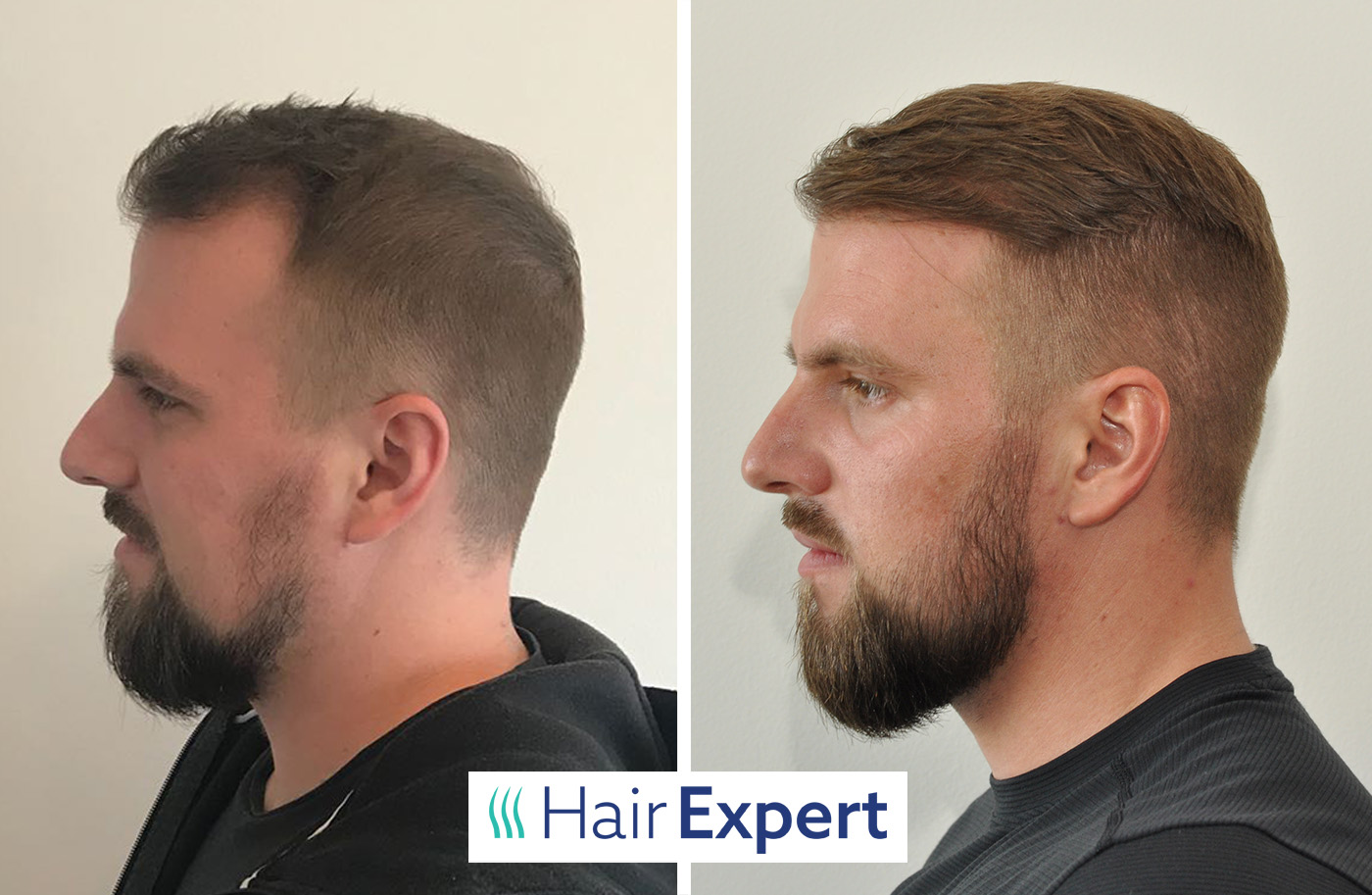 HairExpert foto 6