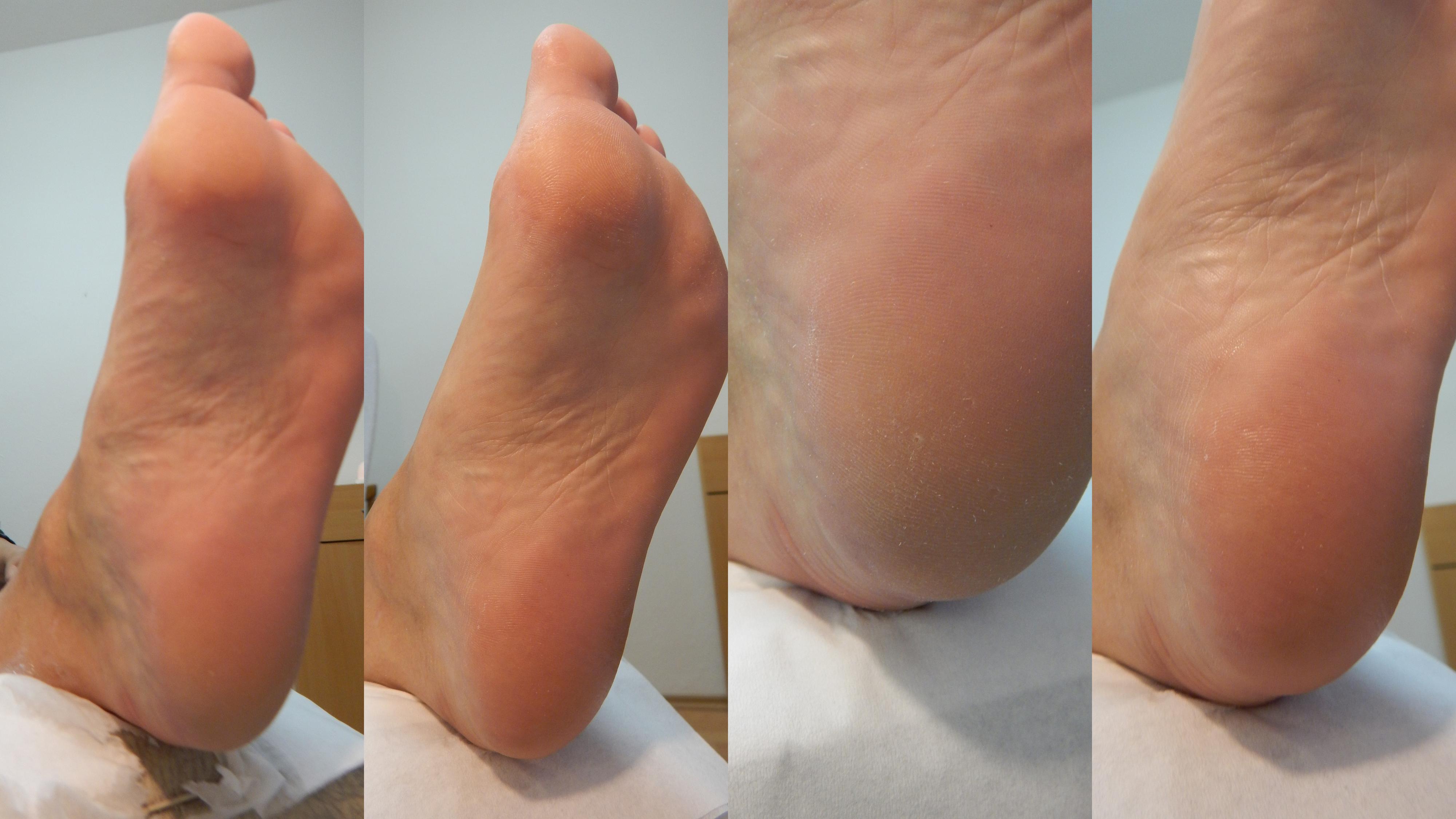 Pedikúra Sezemice - Zdeňka Vaňásková foto 3