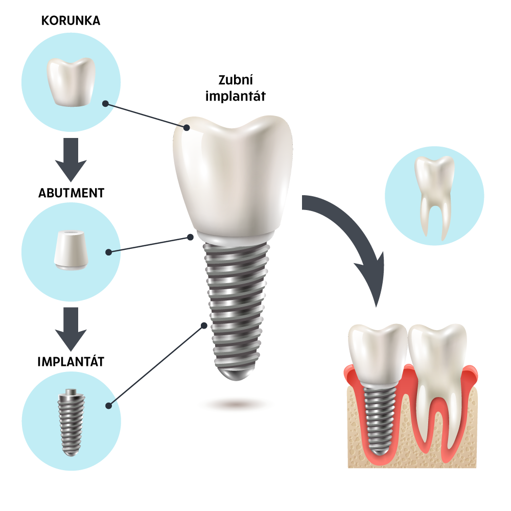 Family Dental Care foto 3