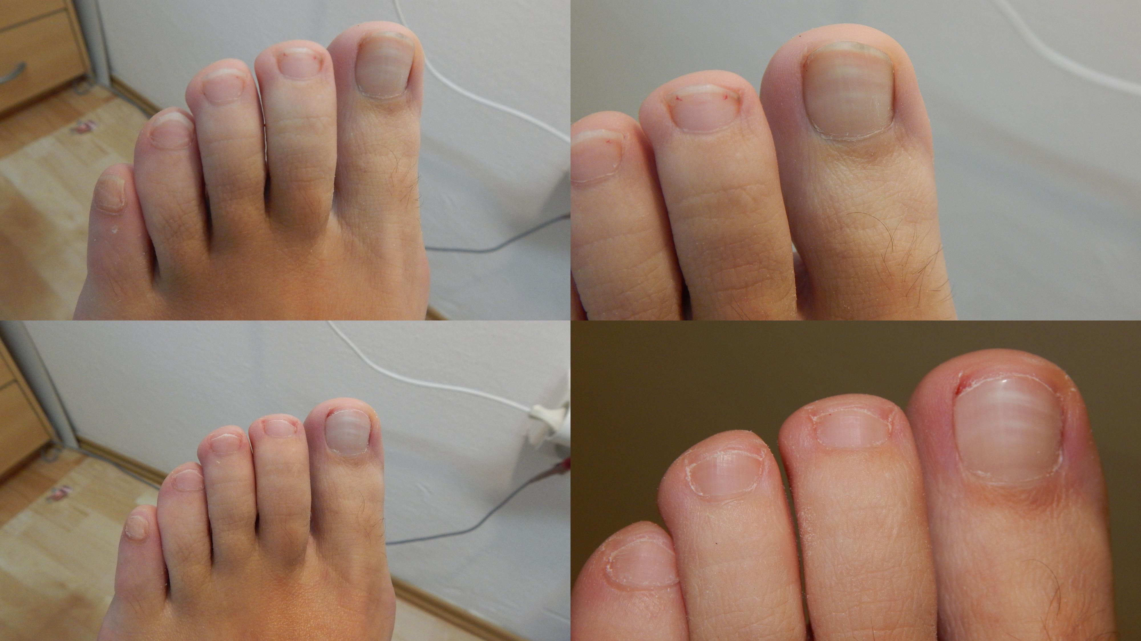 Pedikúra Sezemice - Zdeňka Vaňásková foto 4