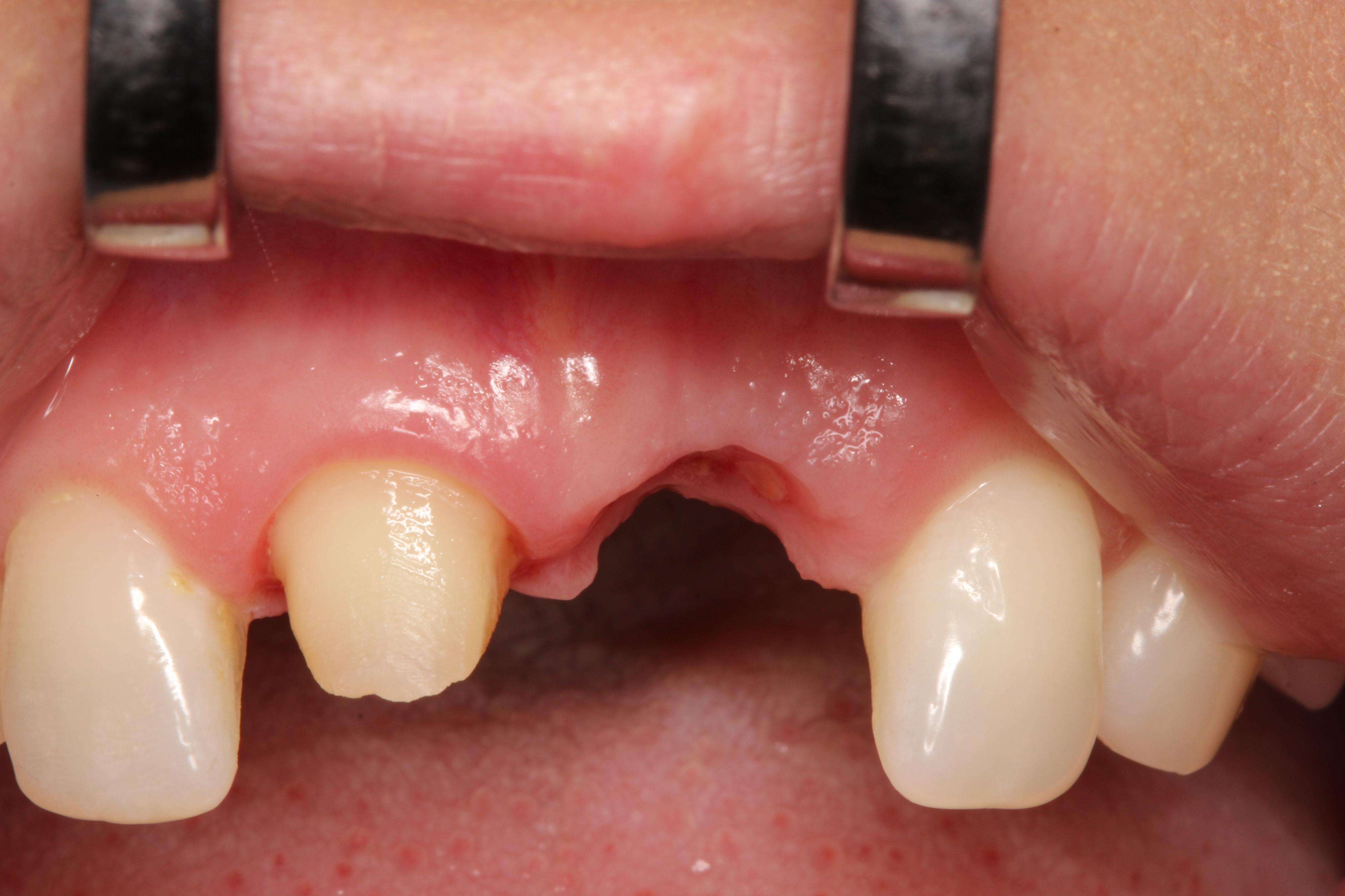 HDC Kladno - Zubní laboratoř foto 3