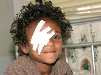 Světlo pro svět - Light for the World foto 4