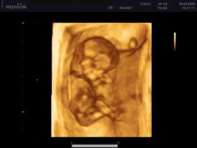 GYNET AH, spol. s r.o. foto 3