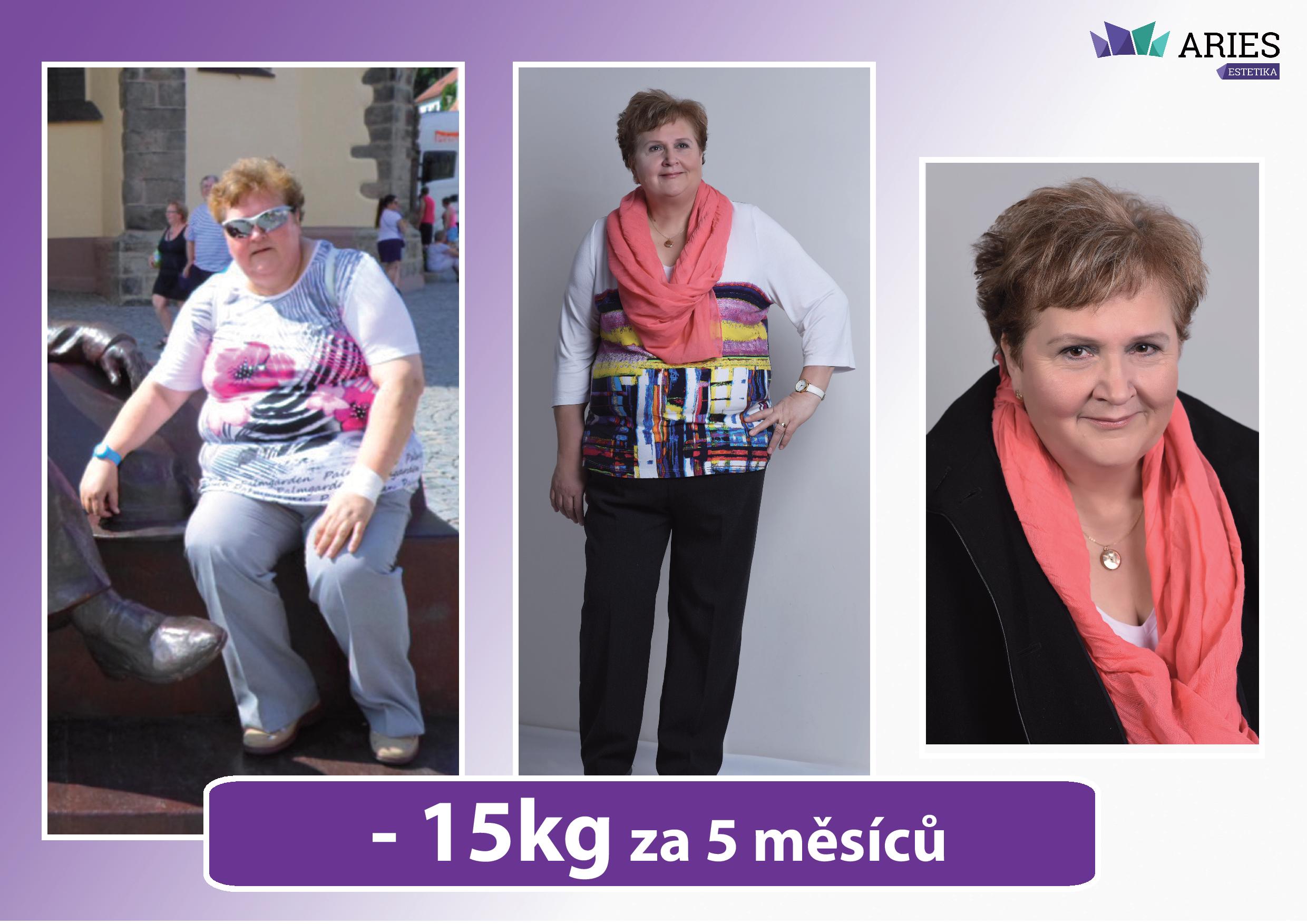 ARIES, klinika komplexní estetiky, s.r.o. foto 3