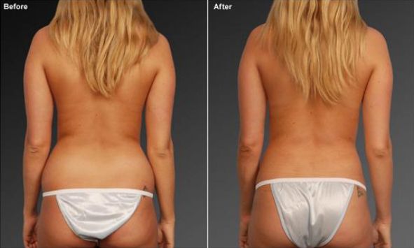 Ronia Clinique foto 4