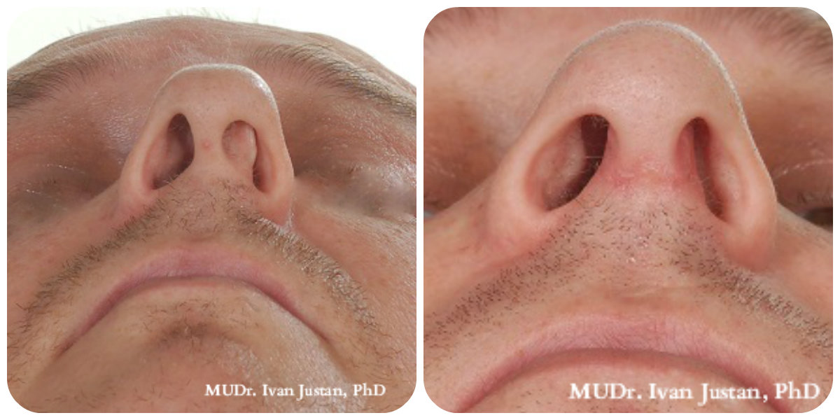 Plastická a estetická chirurgie, MUDr. Ivan Justan foto 6