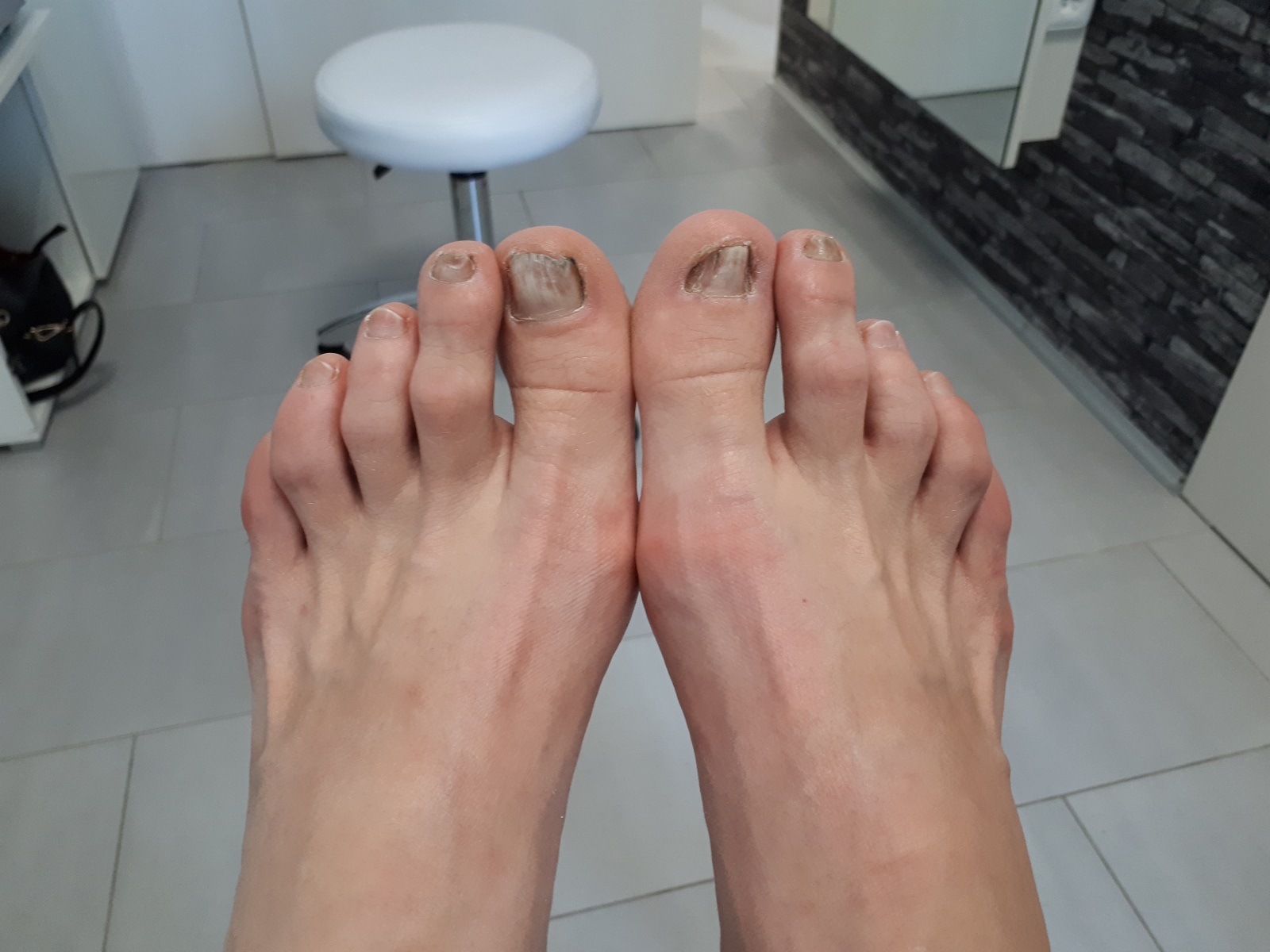 Pedikúra Bc. Zuzana Mynářová foto 4