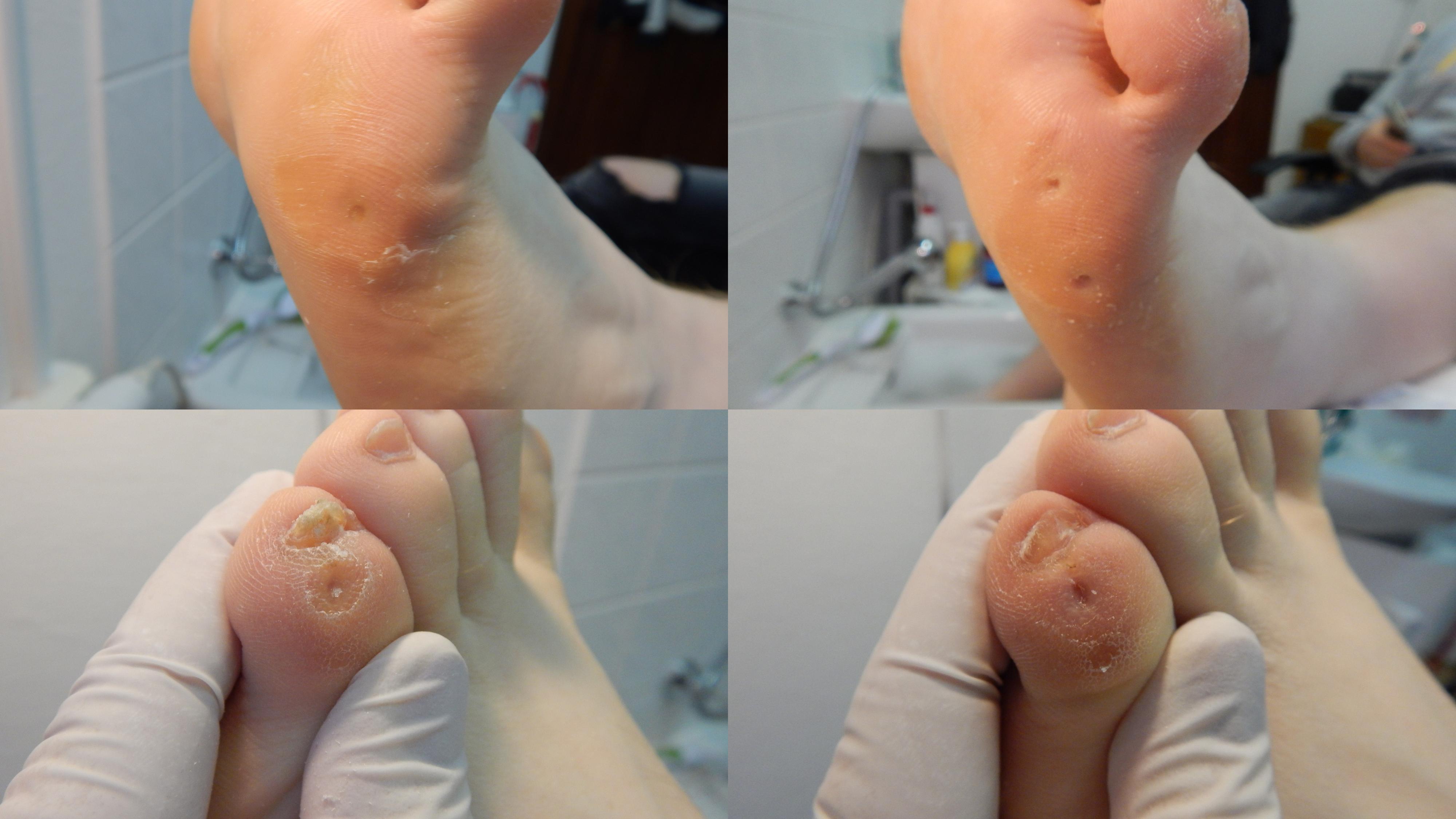 Pedikúra Sezemice - Zdeňka Vaňásková foto 2