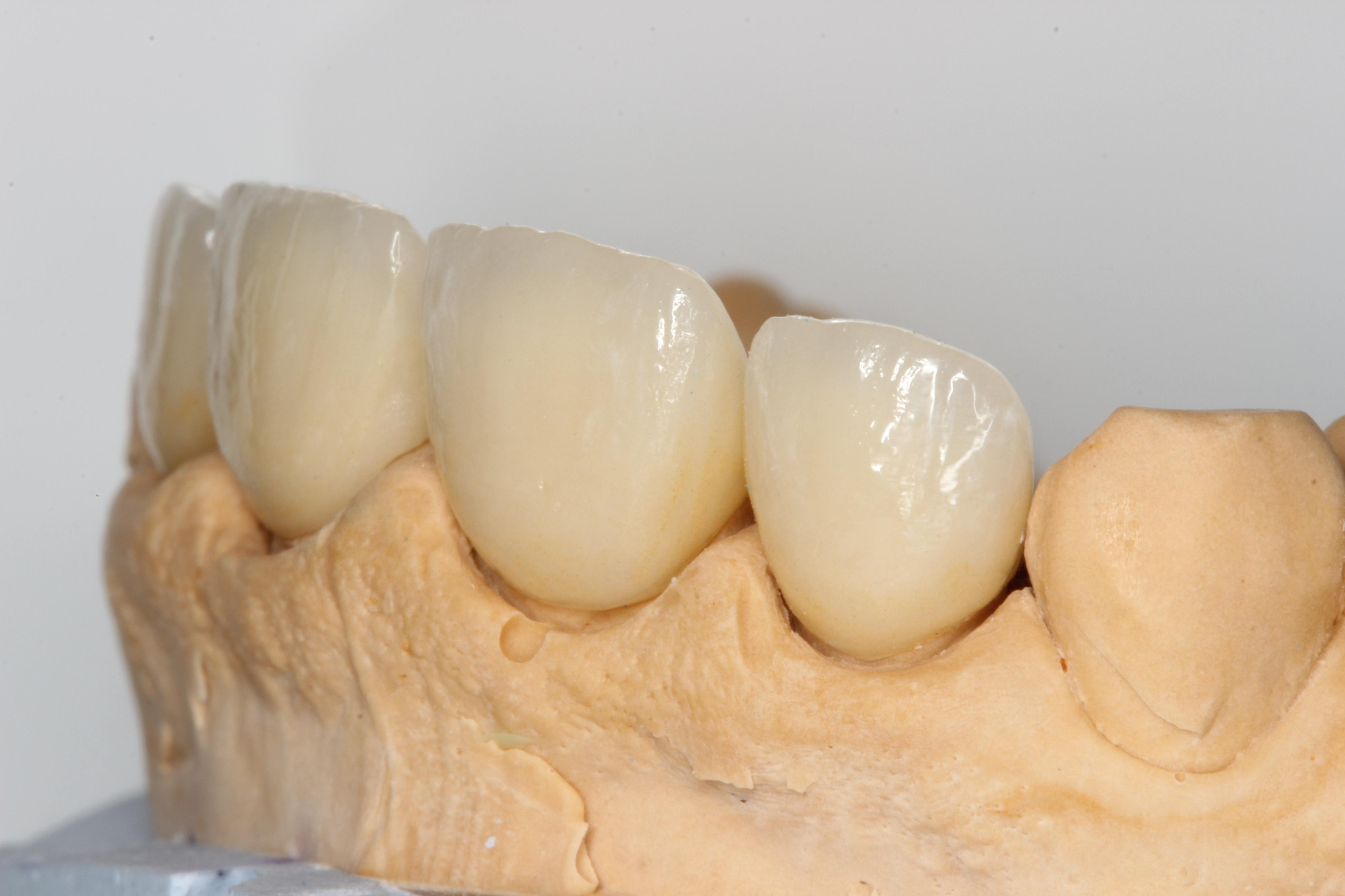 HDC Kladno - Zubní laboratoř foto 2