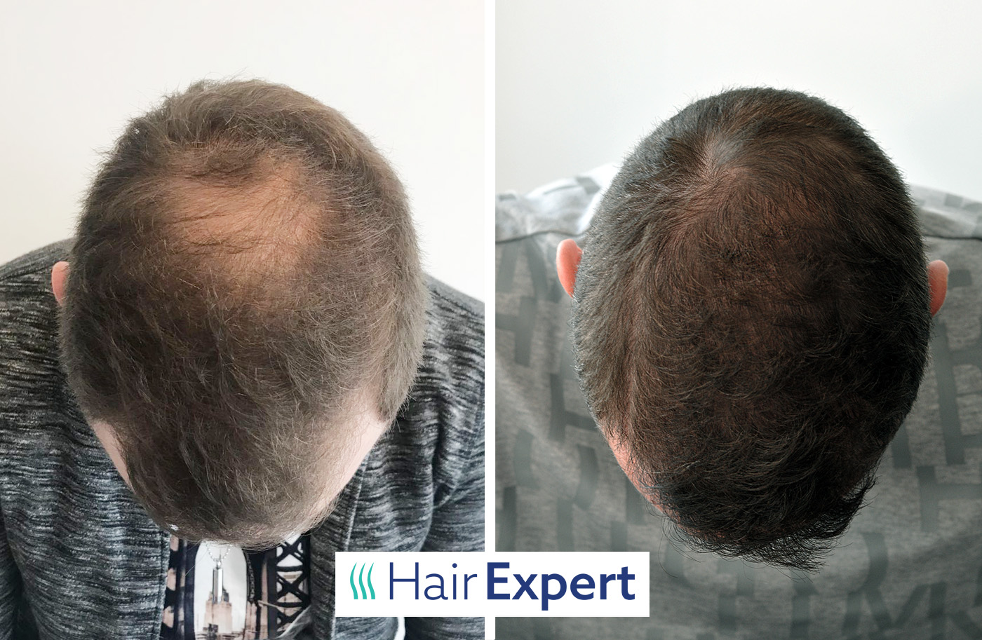 HairExpert foto 4