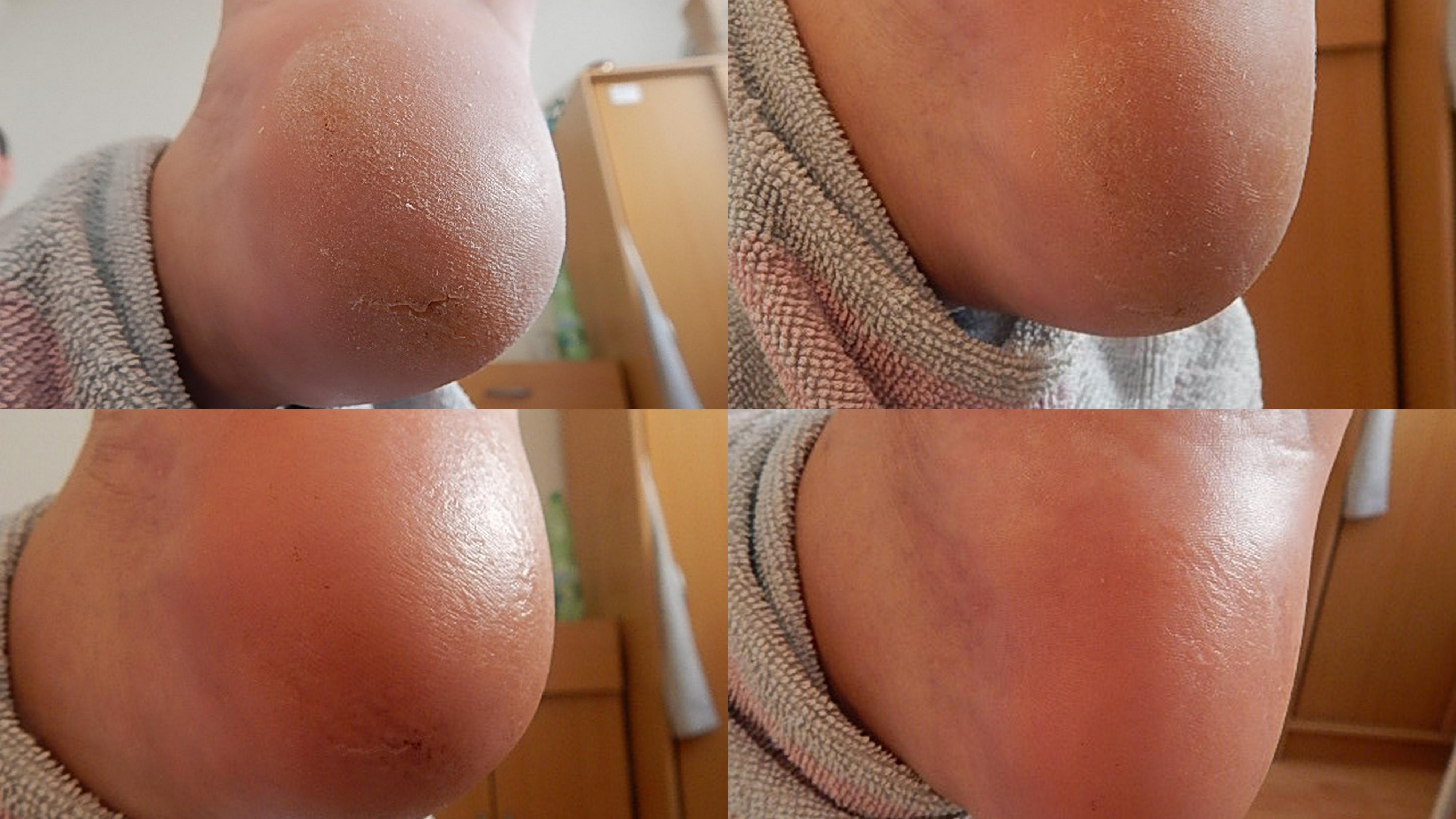 Pedikúra Sezemice - Zdeňka Vaňásková foto 3