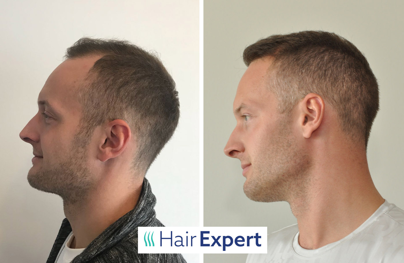 HairExpert foto 3
