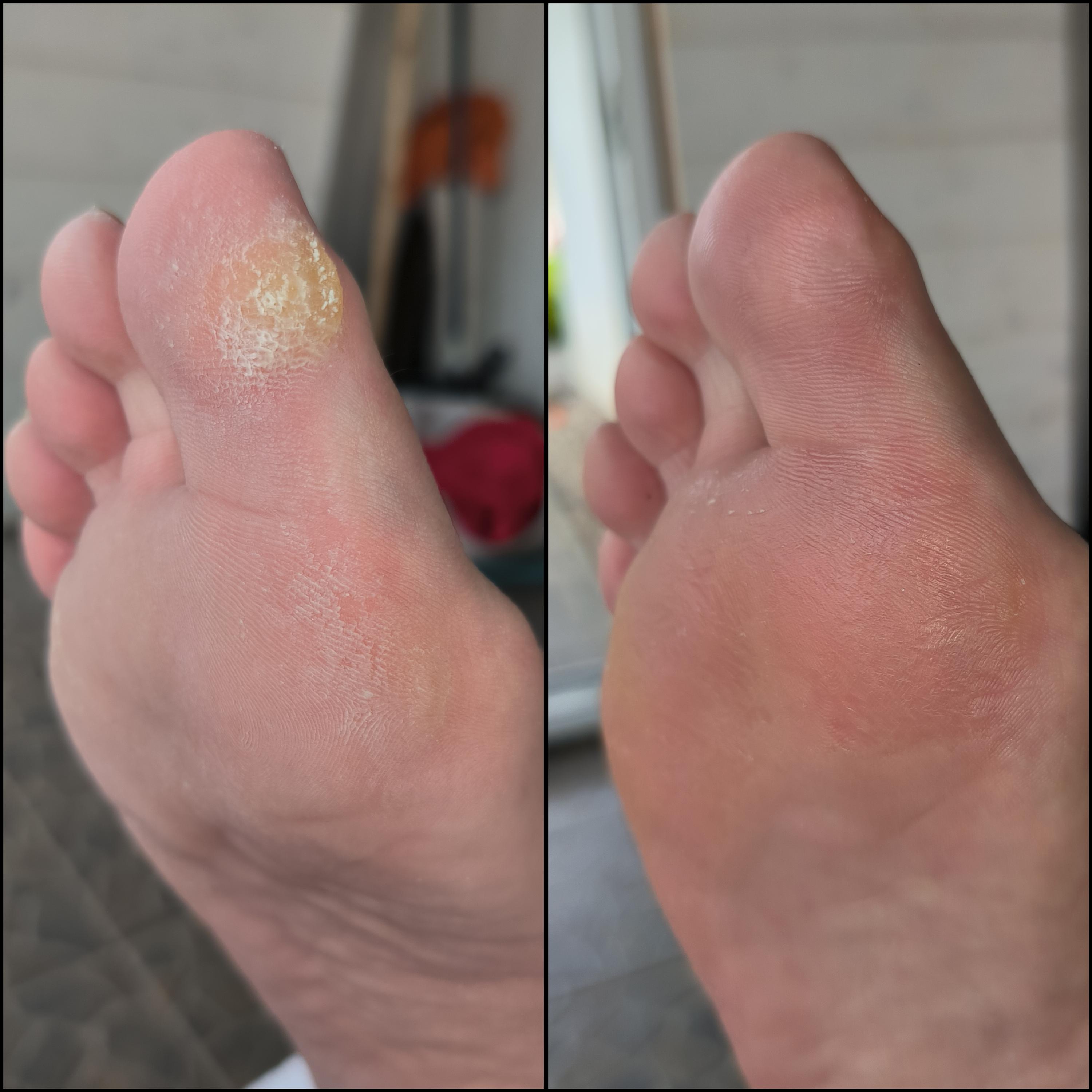 Mobilní pedikúra Nikola Kruliš foto 5