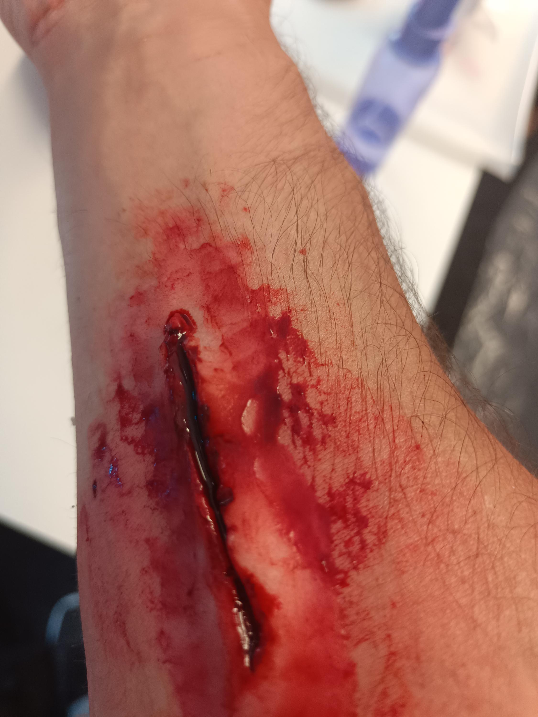 Emergency rescue Prostějov foto 5