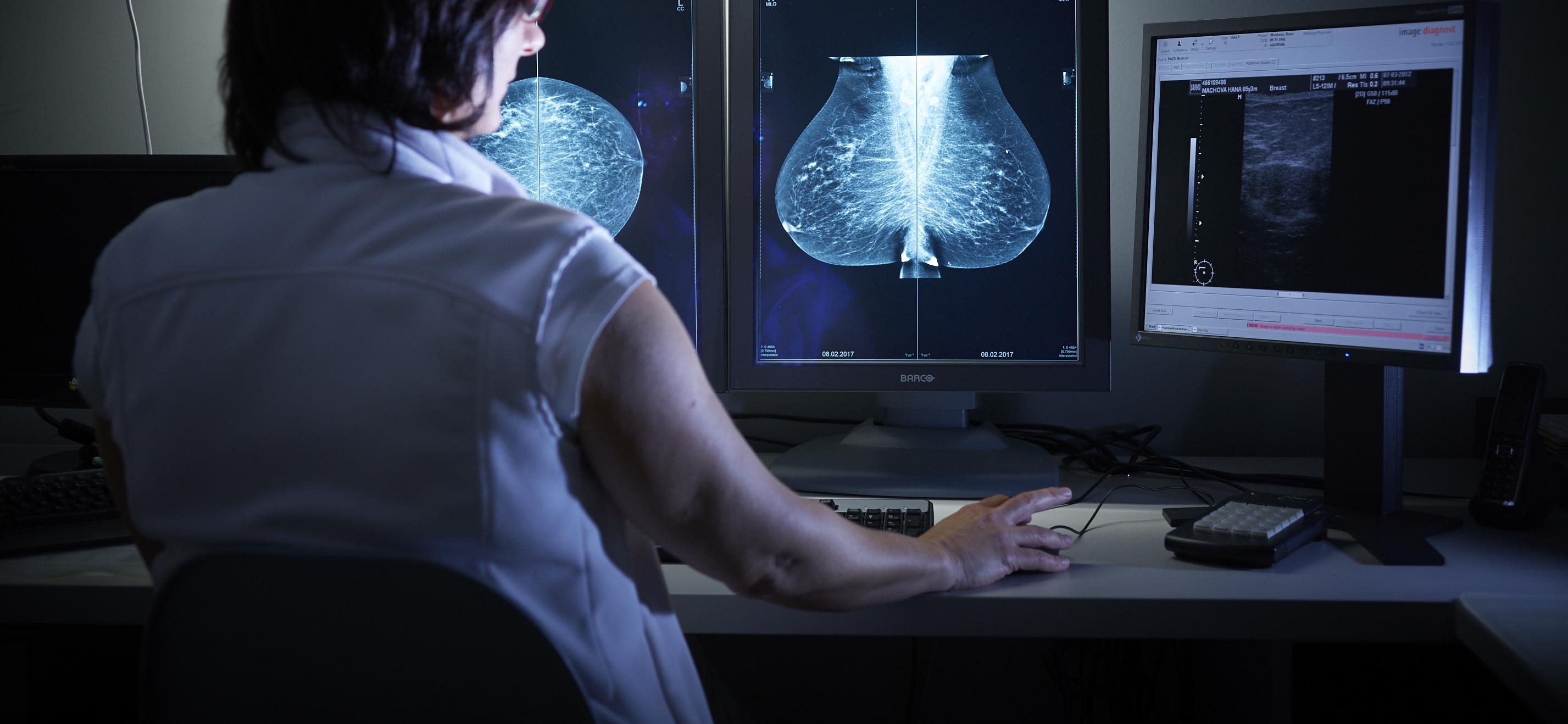 EUC Klinika České Budějovice s.r.o. - Mamologie a mamografie