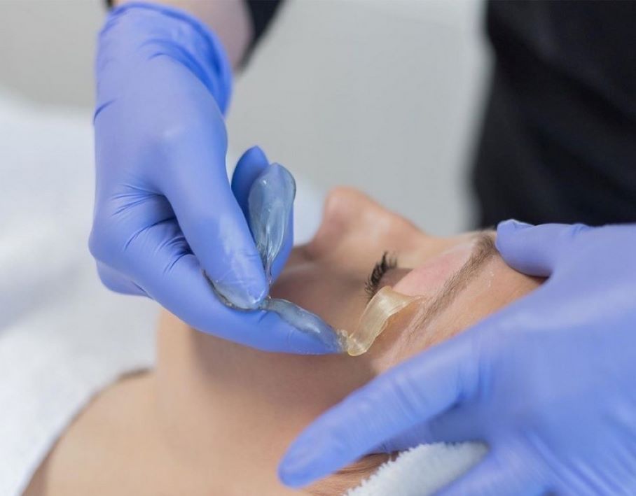 Epilace obličeje horkým voskem