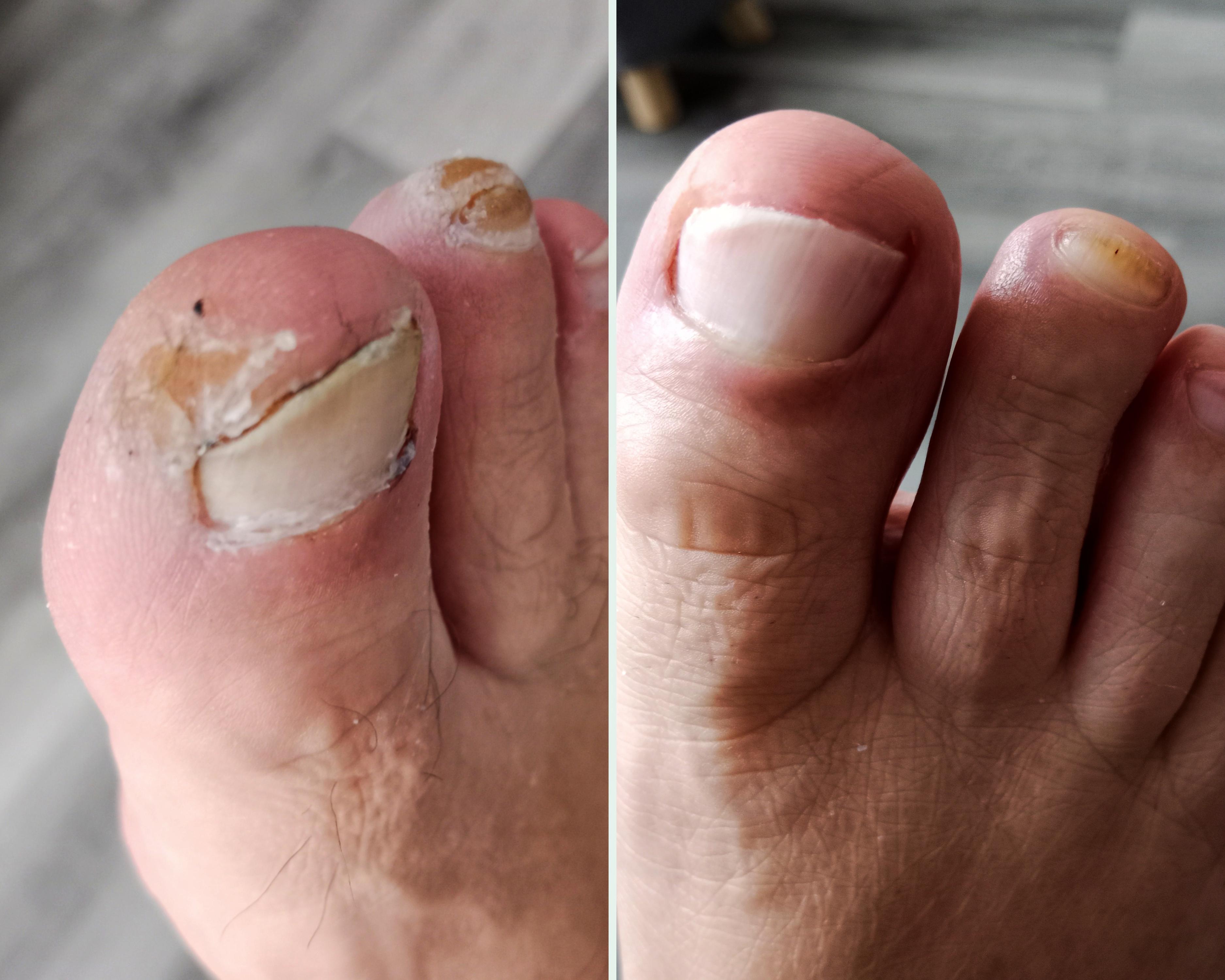 Pedi Markét foto 5