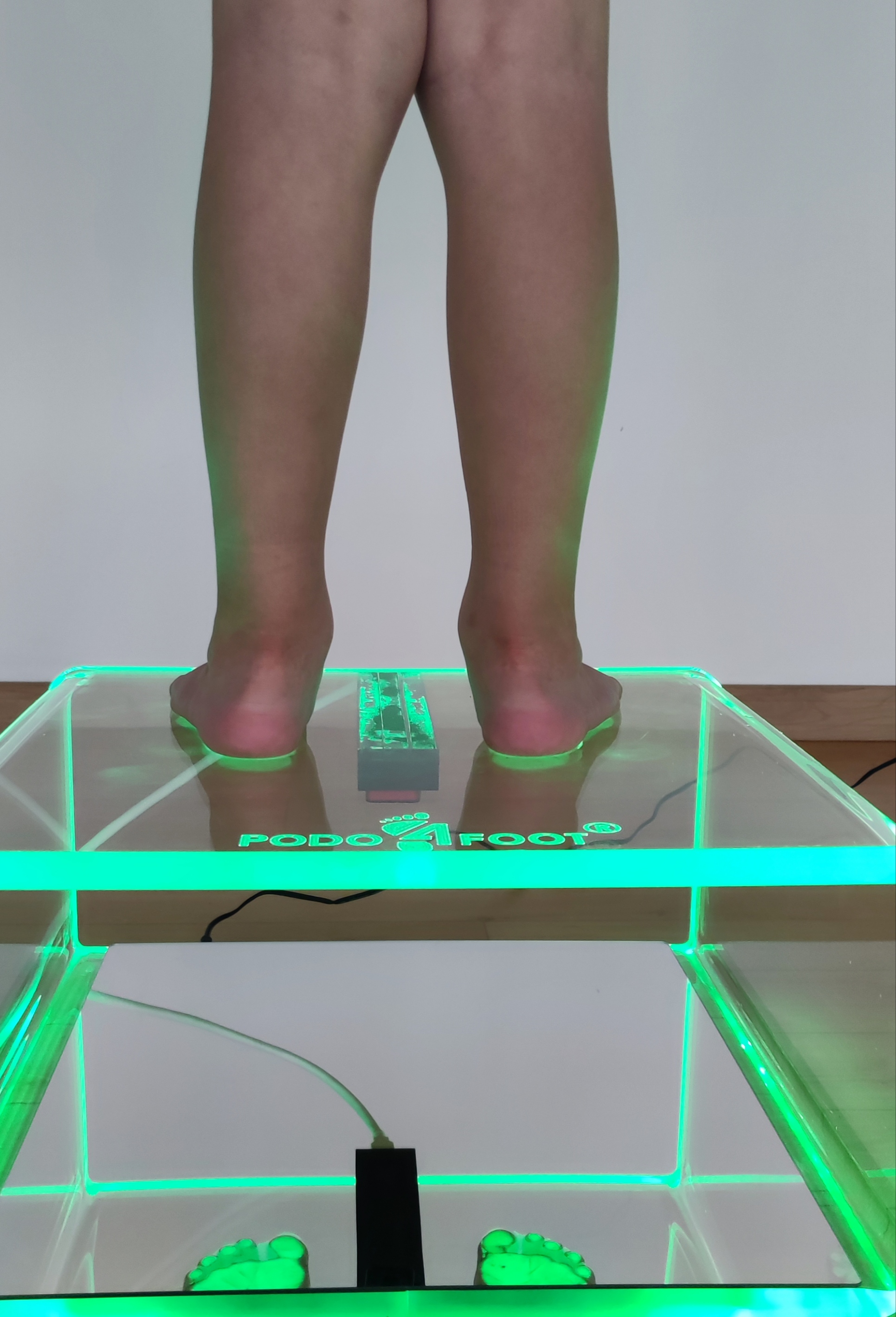 Vyšetření chodidel na podoskopu