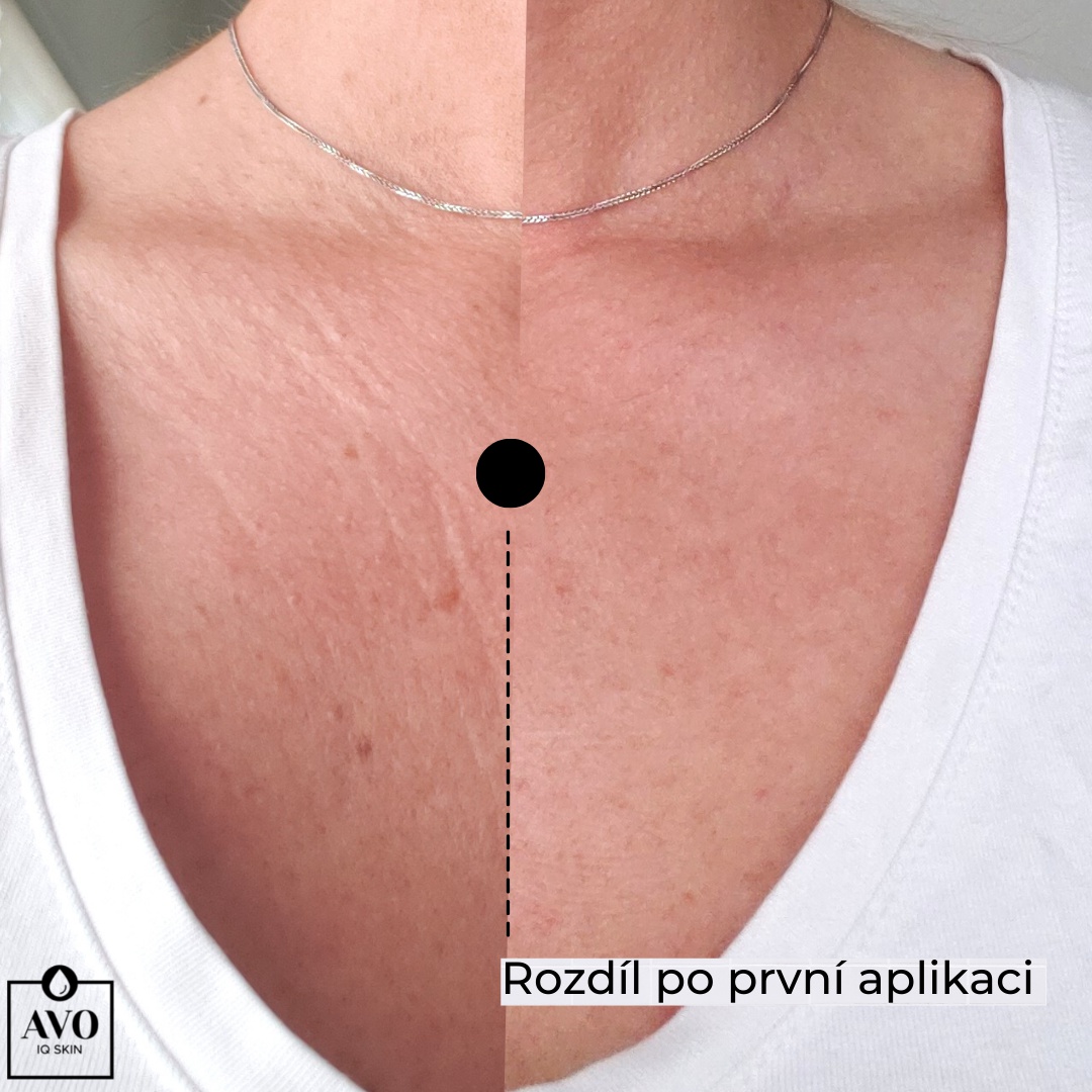 AVO IQ SKIN foto 3