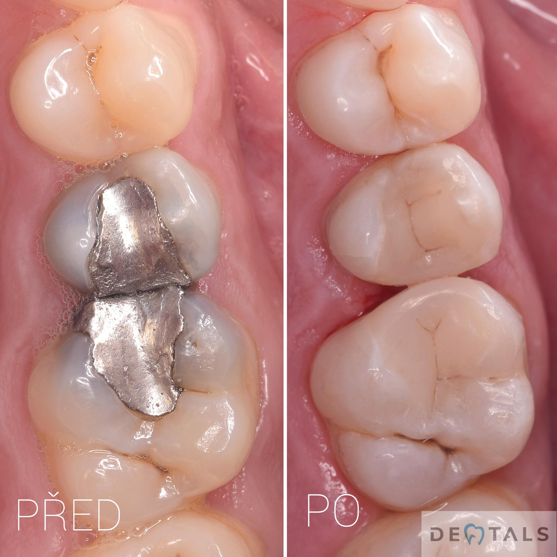 Dentals foto 4
