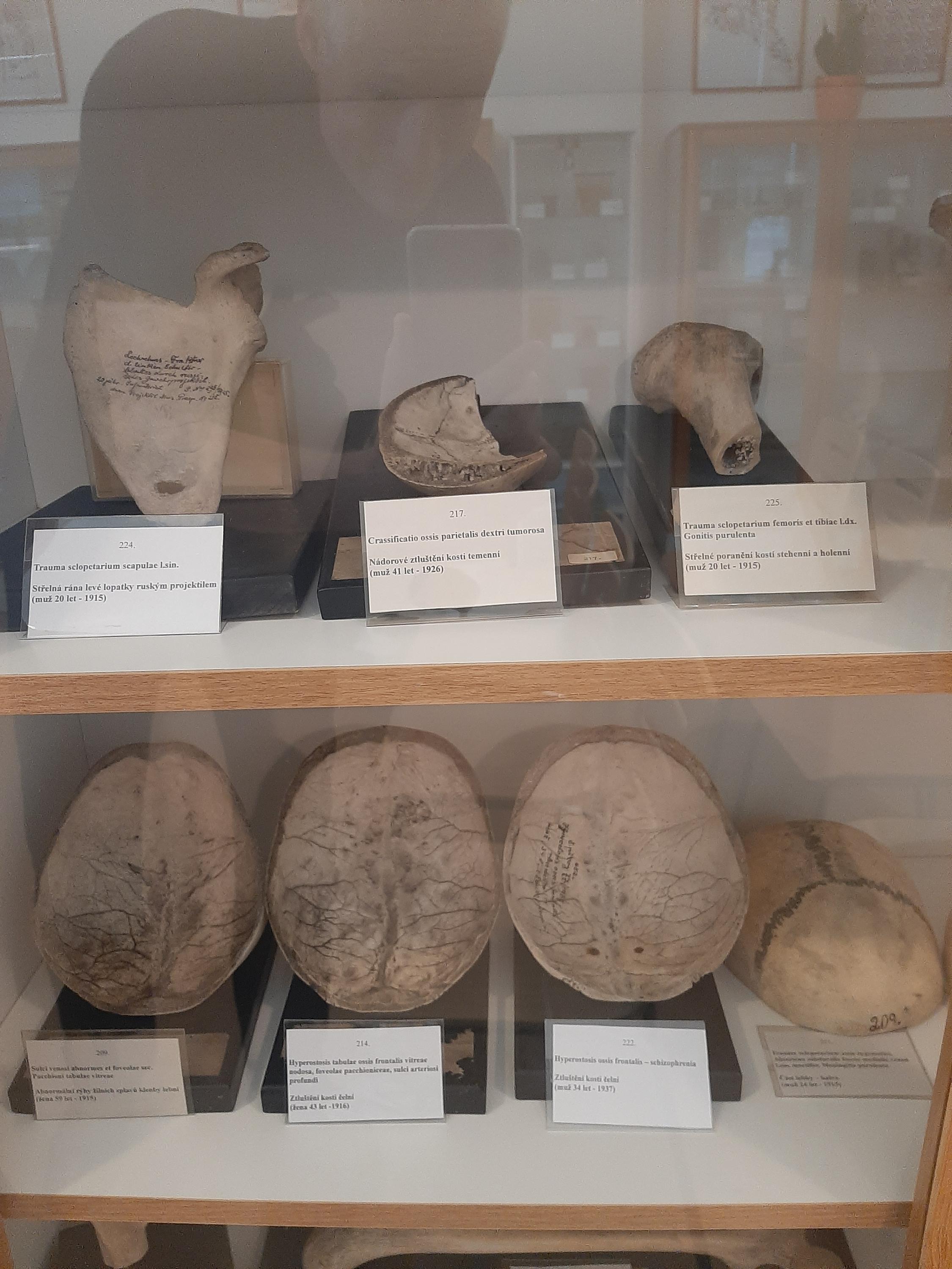 Muzeum patologie - Moravskoslezská nemocnice Opava foto 3