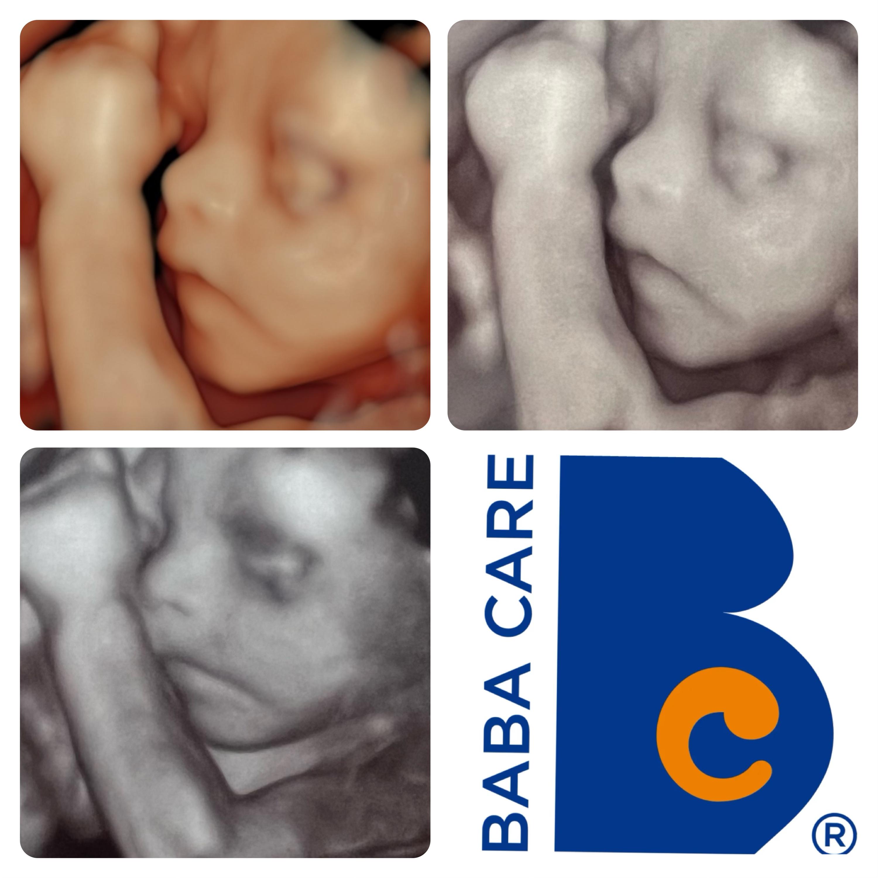 Gynekologie bABa CARE foto 2