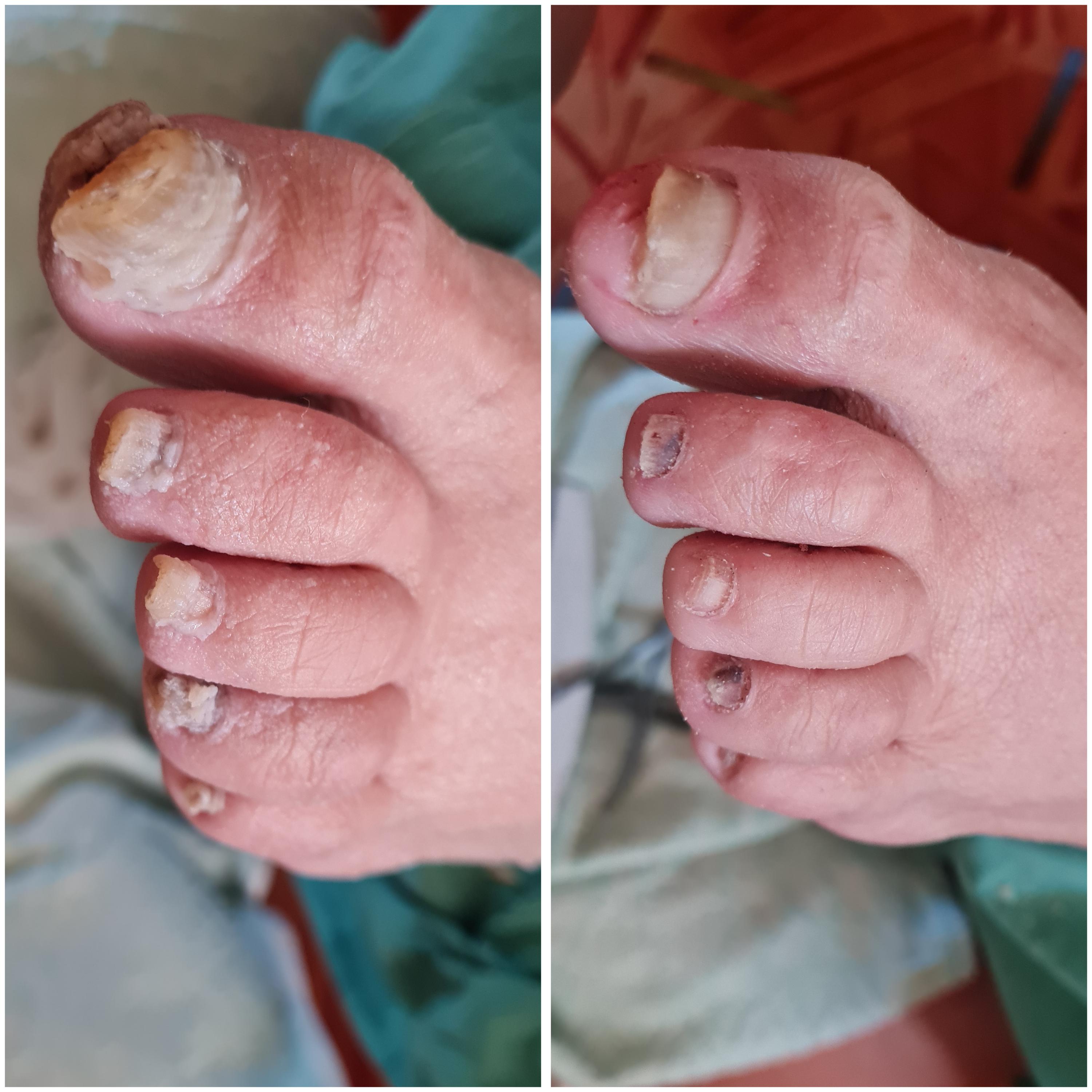 Pedikúra Jana Vašíčková foto 3