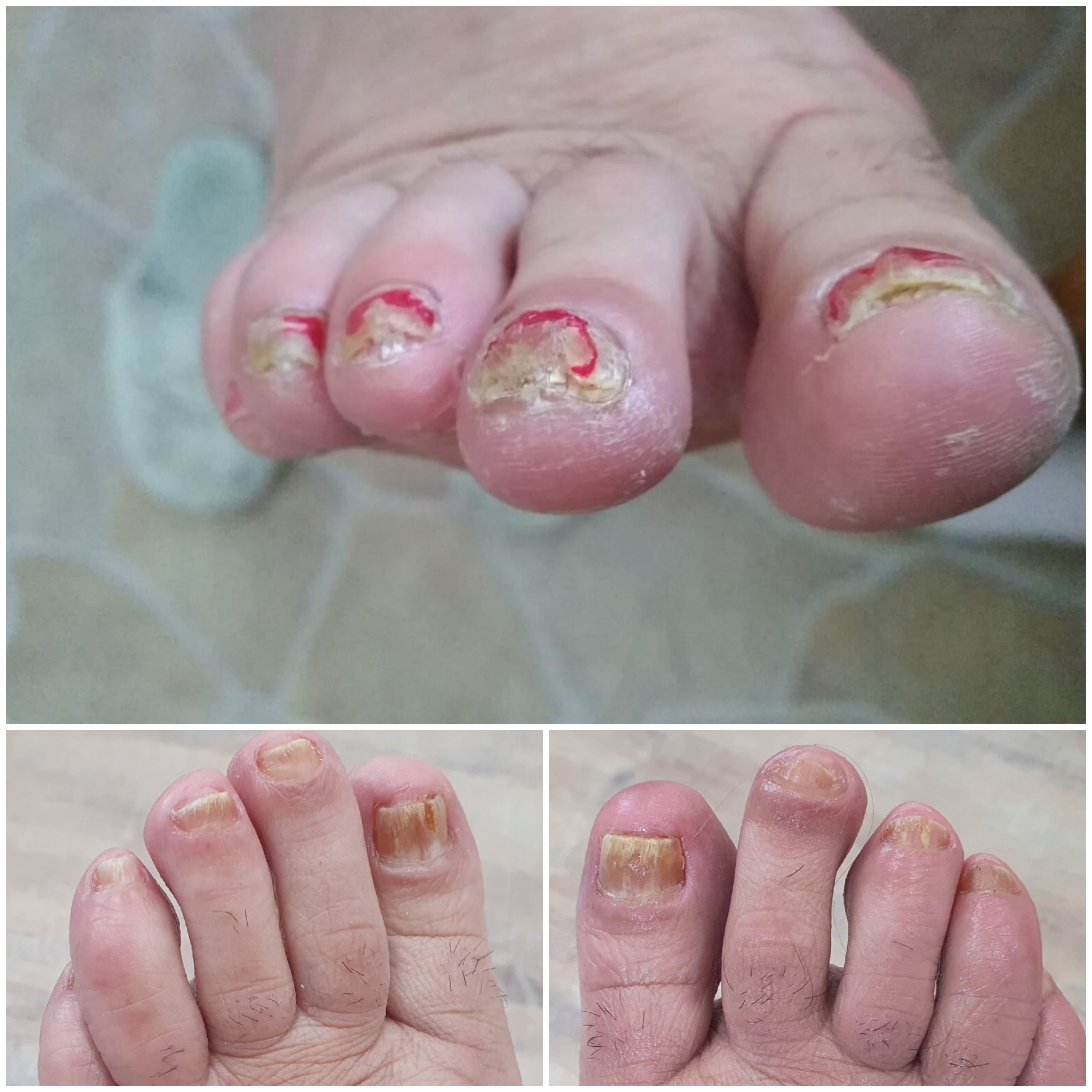 Pedikúra - podologie Olina Procházková foto 2