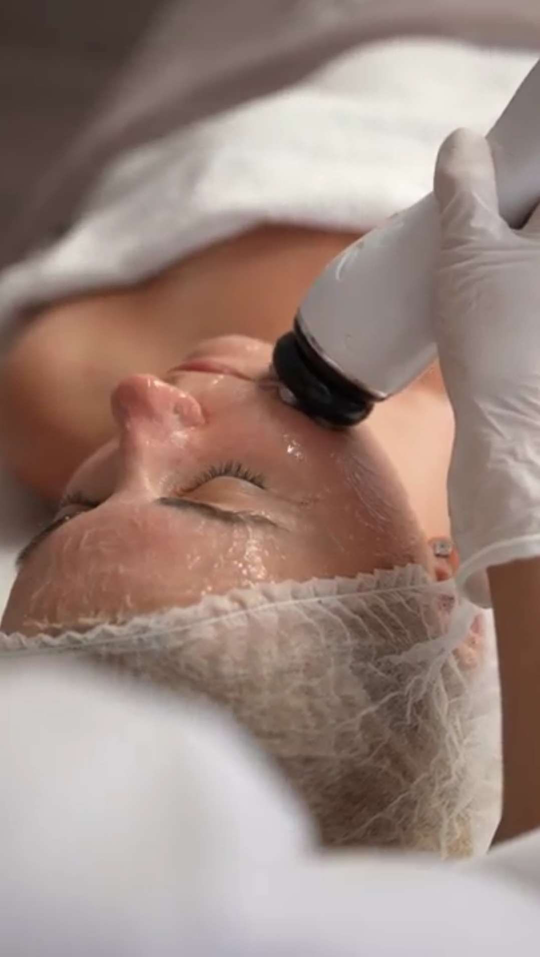 Doelis aesthetic foto 4