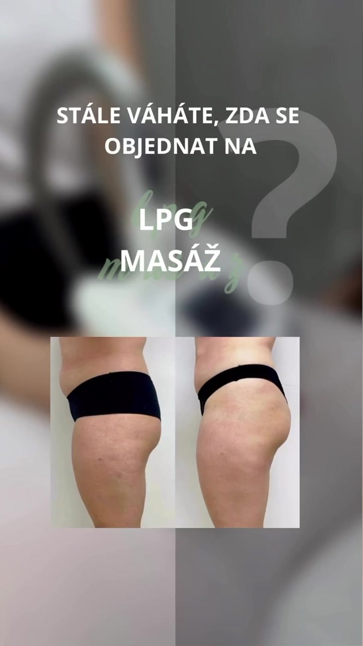 Esthet-ReForma foto 2 (náhled videa)